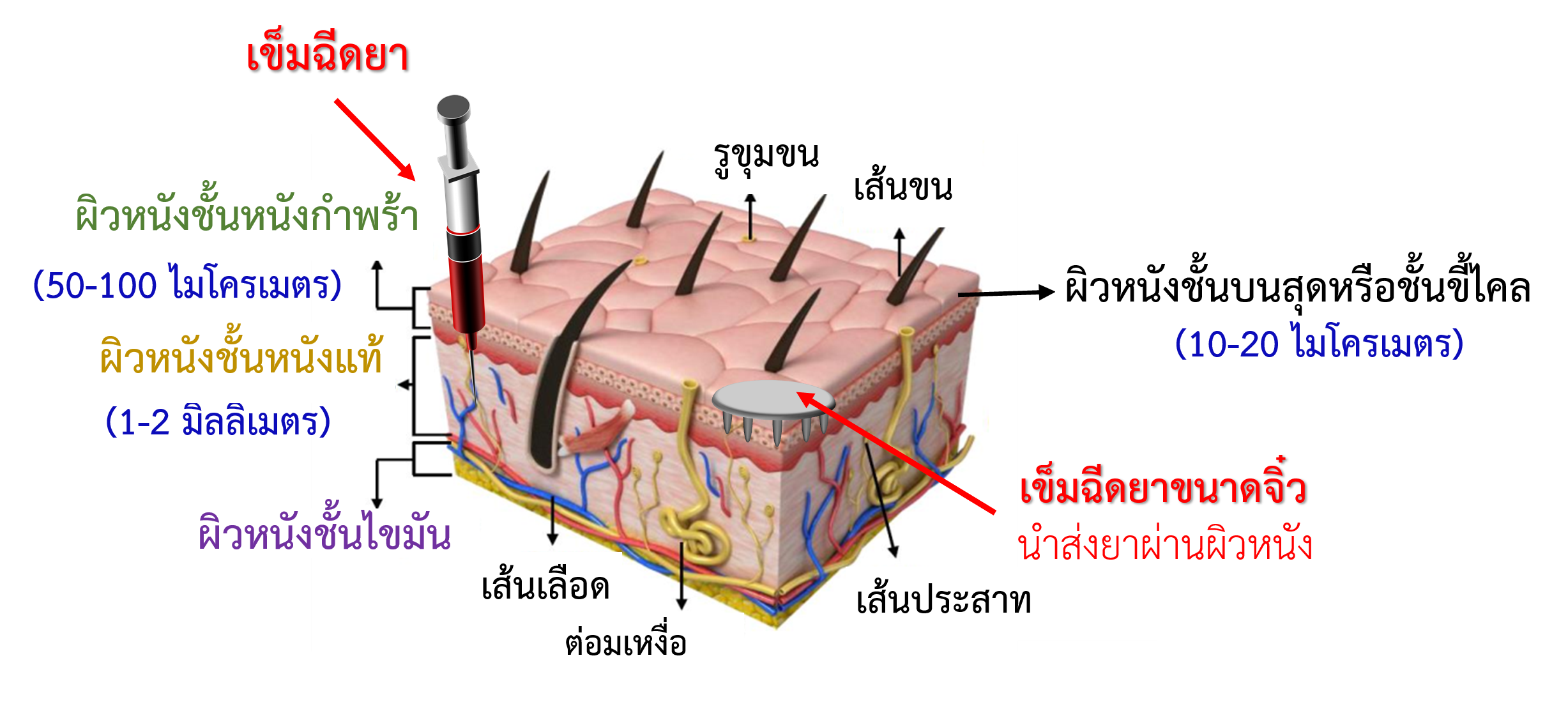 microneedle
