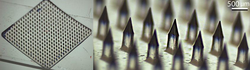 microneedle 2