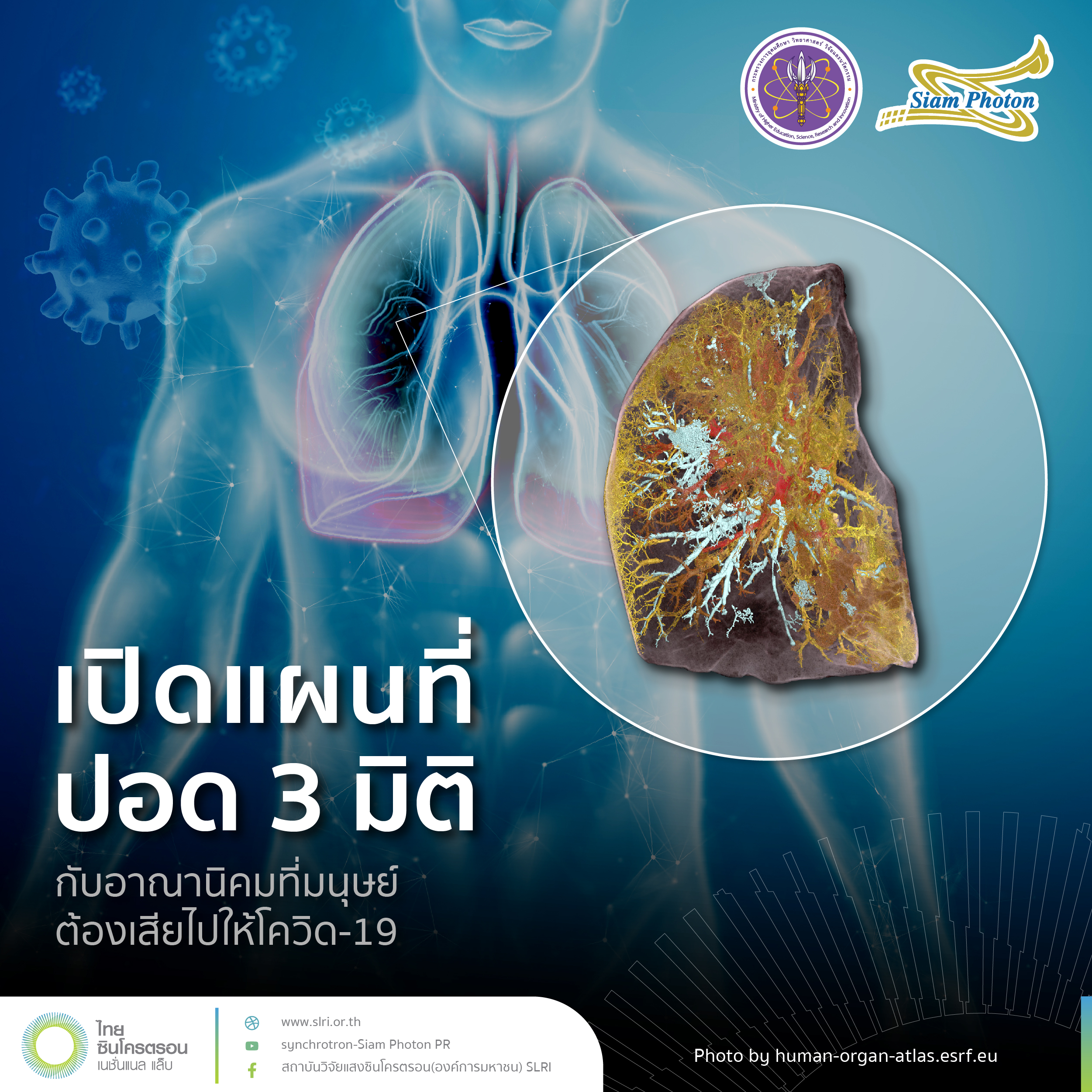 SLRI แผนทปอด 3 มต edit 02