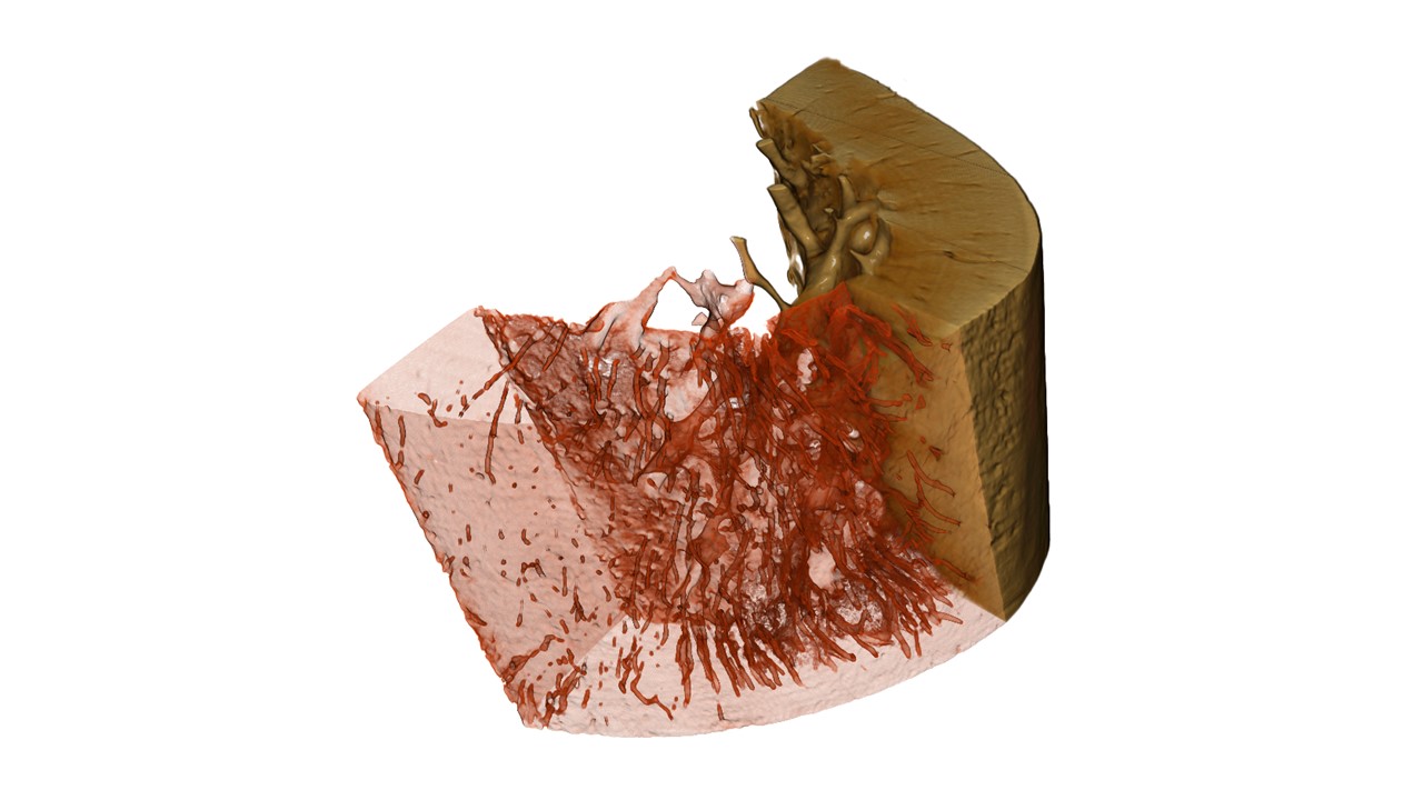Bone 6