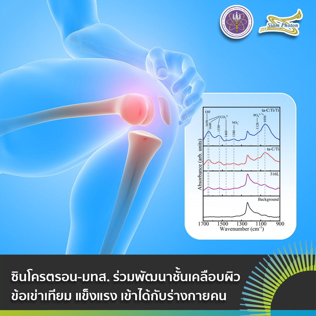 facebook มองกระดกดวยแสงซนโครตรอน